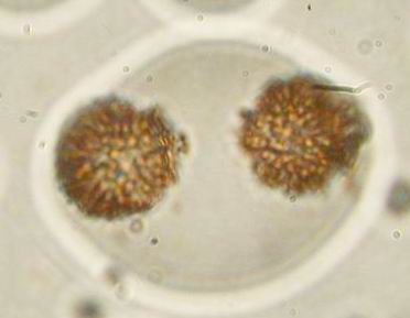 Spore di Astraeus hygrometricus